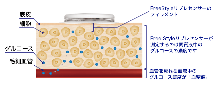 リブレの仕組み